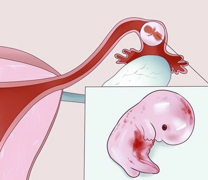 feto-trompas-falopio